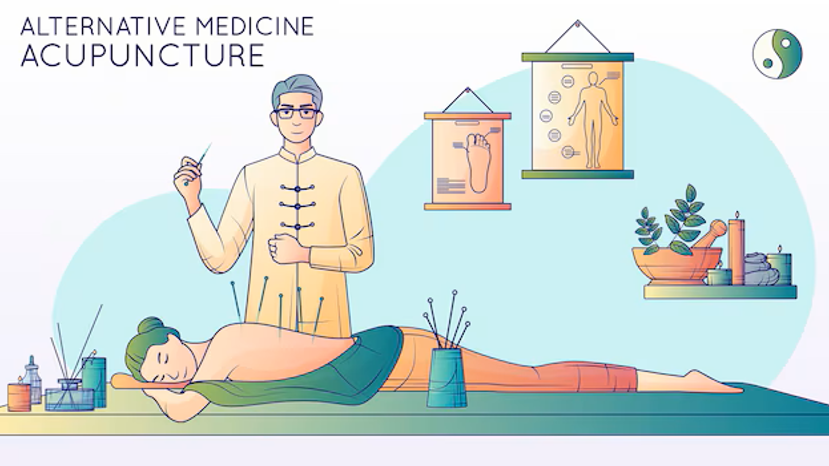 Acupuncture